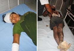 Sia Devi and Mohd. Nazir  under treatment at the Civil Hospital, Phagwara