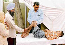 Doctors examine a physically challenged boy at a free polio check-up and surgery camp organised by the Narayan Sewa Sansthan in Ludhiana on Sunday.