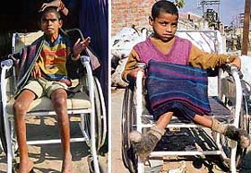 Sonu (15) and Dinesh (14), two of the many needy persons under the constant care of Guru Ram Das Apahaj Ashram Trust in Ludhiana