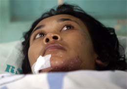 A survivor from a capsized ferry lies in a hospital after being rescued by a fisherman in Rembang, Central Java, on Sunday.  Reuters/ Sigit Pamungkas (Indonasia)
