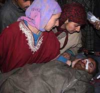 Injured Shabir Ahmed with his relatives at a hospital after a grenade blast in the main Shopian market on Saturday.
