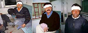 Some of the passengers injured in a train accident at the Ludhiana railway station on Saturday.