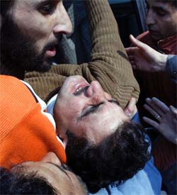 A civilian who was injured in a grenade attack at Pattan being taken to hospital in Srinagar on Monday.