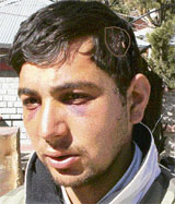 Nineteen-year-old Suresh Kumar