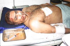 Deepak Bali, under treatment in a Hospital in Jalandhar on Wednesday night. 
