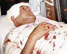 External Affairs Minister Pranab Mukherjee at Shaktinagar Hospital in Krishnanagar after he was injured in a road accident on Saturday night. 