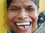 A beaming Manju Sood with her missing teeth restored.