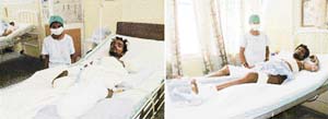 Ram Manohar and Chhote Lal, victims of burn injuries, under treatment at CMCH in Ludhiana
