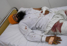Charanjeet Singh (left), who was allegedly shot at by SAD-BJP workers during the Municipal Corporation elections