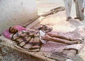 AIDS patient Mohan lies unattended on a cot in a street in Fatehabad