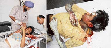 Two of the injured labourers being treated at the civil hospital, Dera Bassi