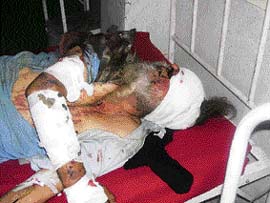 The unidentified accident victim under treatment at the civil hospital, Nurpur, on Friday.