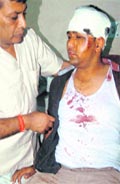 Sukhwinder Singh and Sham Lal who were injured during a clash between SAD and BJP workers at Bari Karoran village in Naya Gaon