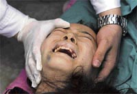 Li Yi (10) screams as her left leg is amputated to rescue her from the ruins of a collapsed building at Miaoba primary school in earthquake-hit Beichuan county, about 160 km of the epicentre at Wenchuan county, Sichuan province