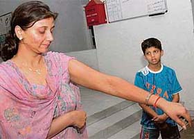 Shweta, along with her son, shows her bruises at the Sector 17 police station in Chandigarh