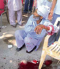 A Congress worker who suffered injuries in poll violence in ward No. 8 of Bathinda on Monday.