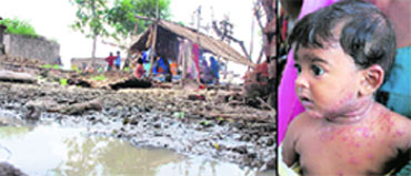 The deplorable sanitary conditions in Dera Halwana village. It is believed the disease spread due to such conditions and (right) a child affected by the disease at a temporary dispensary set up in the village