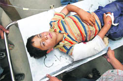 A young boy, who was injured in the Banihal militant attack, lies on a stretcher outside a Srinagar hospital on Friday.