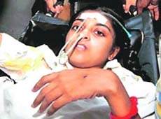 After being rebuked by one of the judges in a dance competition on TV, she went into deep depression