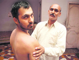 Father Birbal Sharma shows the marks on Harishs back he sustained in a police thrashing in Jammu on Sunday.