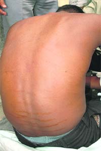 Gurdeep shows cane marks on his back