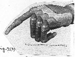 Bionic hand