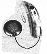 Bionic ear