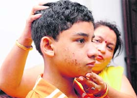 Rishabs mother shows bruises on her sons face in Chandigarh