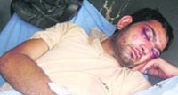 A victim of a clash at Dhulkot village. 