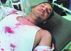 Vishal Sharma, the accused, in the Sector 16 hospital in Chandigarh
