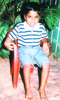 The boy whose club foot was cured through the intercession of Blessed Alphonsa