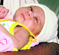 The one-and-half-month-old baby girl who underwent an open heart surgery at the PGI.