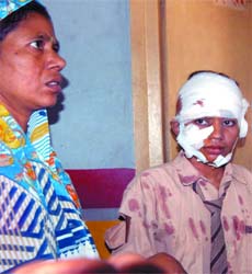 An injured child with his mother at Lal Bahadur Shastri Hospital after the bus turned turtle at new Kondli area of East Delhi on Monday morning