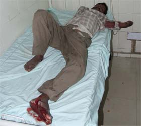 A man who was injured in an accident at Expressway on Friday morning
