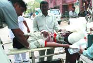 An injured person at LNJP Hospital in New Delhi