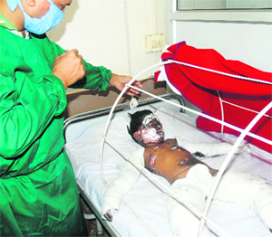 Five-year-old Moromi struggles for life at Guwahati Medical College Hospital on Friday. 