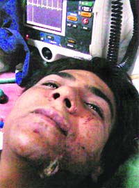 In this undated handout photograph released by the Mumbai police on Monday, arrested Islamist militant Azam Ameer Qasab is seen lying on a bed at an undisclosed location in Mumbai