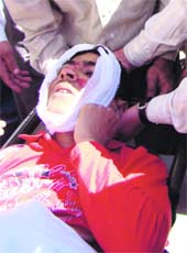 An injured victim of a bus accident is taken to Government Medical Hospital in Jammu on Wednesday. A bus carrying dozens of passengers from Kisthwar-Bhaderwah skidded off the road and plunged into a deep gorge killing at least 39 persons.
