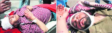 The seriously injured principal Jagdish Raj (left) and bus driver Alamgir of Chirhar battle for life at Govt Medical College, Jammu, on Monday