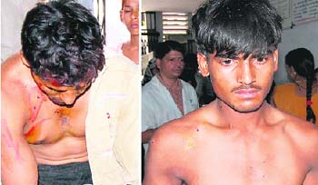 Injured smugglers Shamsher and Khushnood in the district hospital in Dehradun, on Tuesday.