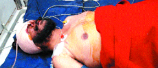Sukhdev Singh under treatment at a private hospital in Jalandhar on Tuesday.
