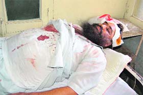 One of the injured in Dera Bassi civil hospital