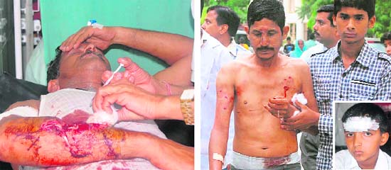 (From left) Seriously injured Prakash Chand in Doon Hospital; IMA employee Mohan Ram being taken to the emergency ward; and (inset) Priyanshu Joshi who saved himself and his sister from the leopard