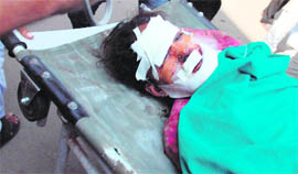 An injured girl being taken to the GMCH, Jammu, on Saturday. 