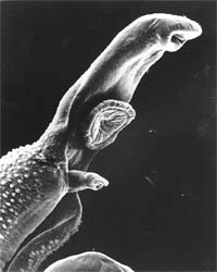 A undated image of schistosome parasite, magnified by 256 times in this photograph