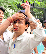 A profusely bleeding lab technician protests in front of the secretariat in Dehradun on Friday.