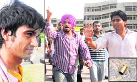 Injured student Praveen; and (right) SOPU leaders raise slogans at UIET. (Inset) Shell of the bullet