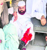Pakistans Religious Affairs Minister Hamid Saeed Kazmi after he was shot in the leg in Islamabad on Wednesday