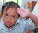 A differently abled boy salutes a doctor after his checkup at a medical camp organised for special children in Jalandhar.