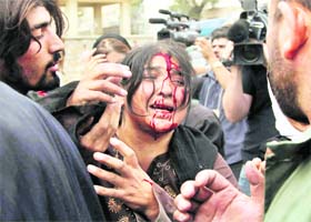 An Afghan woman injured in a suicide attack cries for help near the site where a suicide car bomber attacked an Italian military convoy in Kabul